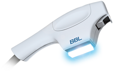 BroadBand Light (BBL™) Treatments