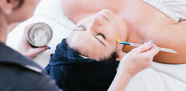 Chemical Peels