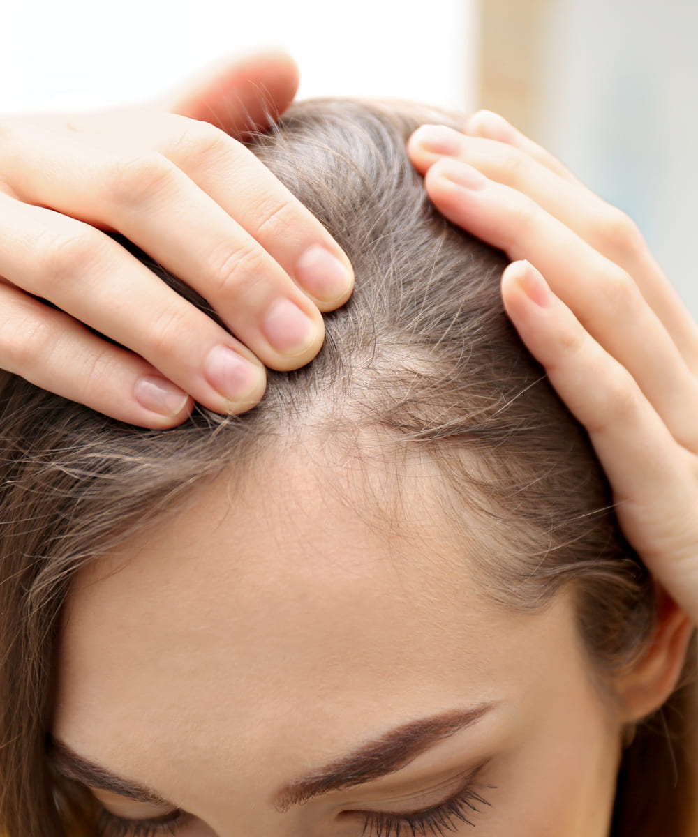 Hair Loss (Alopecia) & Excessive Hair (Hirsutism)