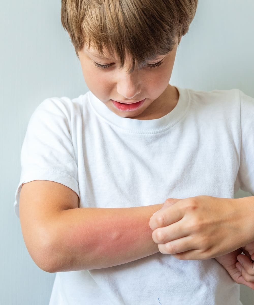 Pediatric Dermatology