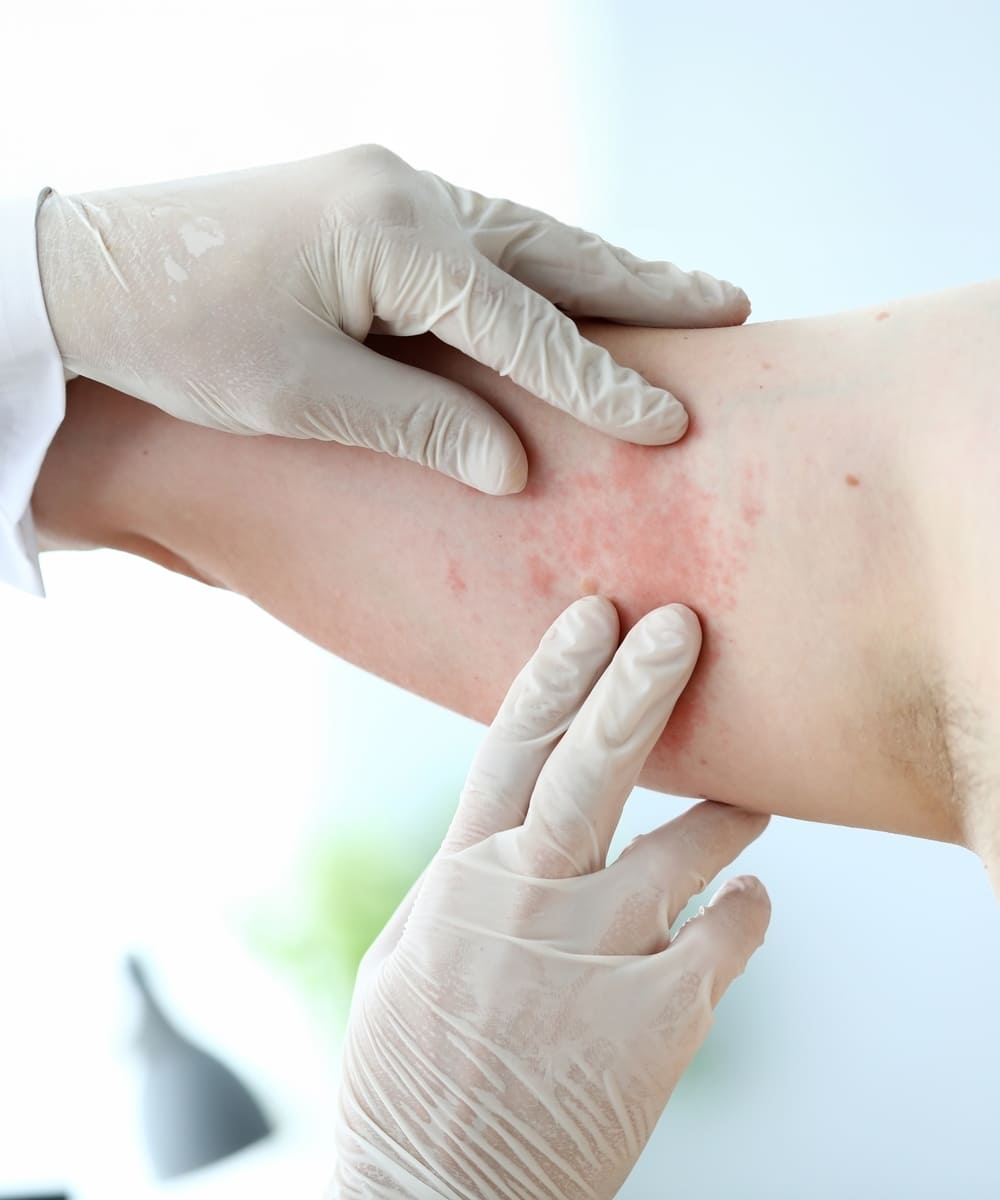 Diagnostic Care for Rashes & Itches