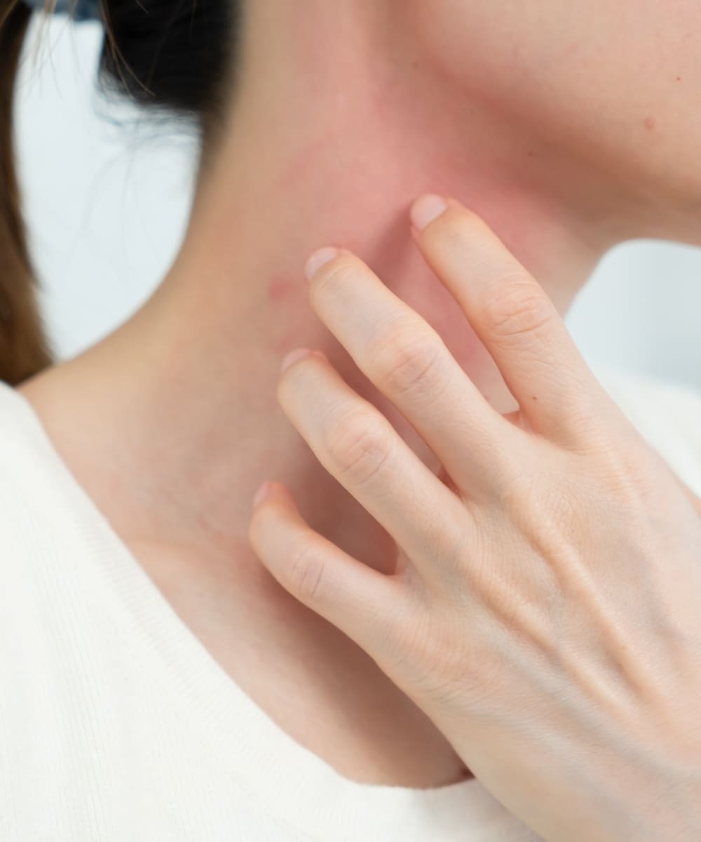 Skin Allergy Evaluation & Patch Testing